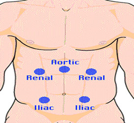 How To Percuss Liver